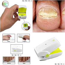 Load image into Gallery viewer, Professional Nail Cleaning Laser Device, Safe, Quick, Painless Nail Fungus Laser Treatment For Toe And Finger Nails, No Side Effects